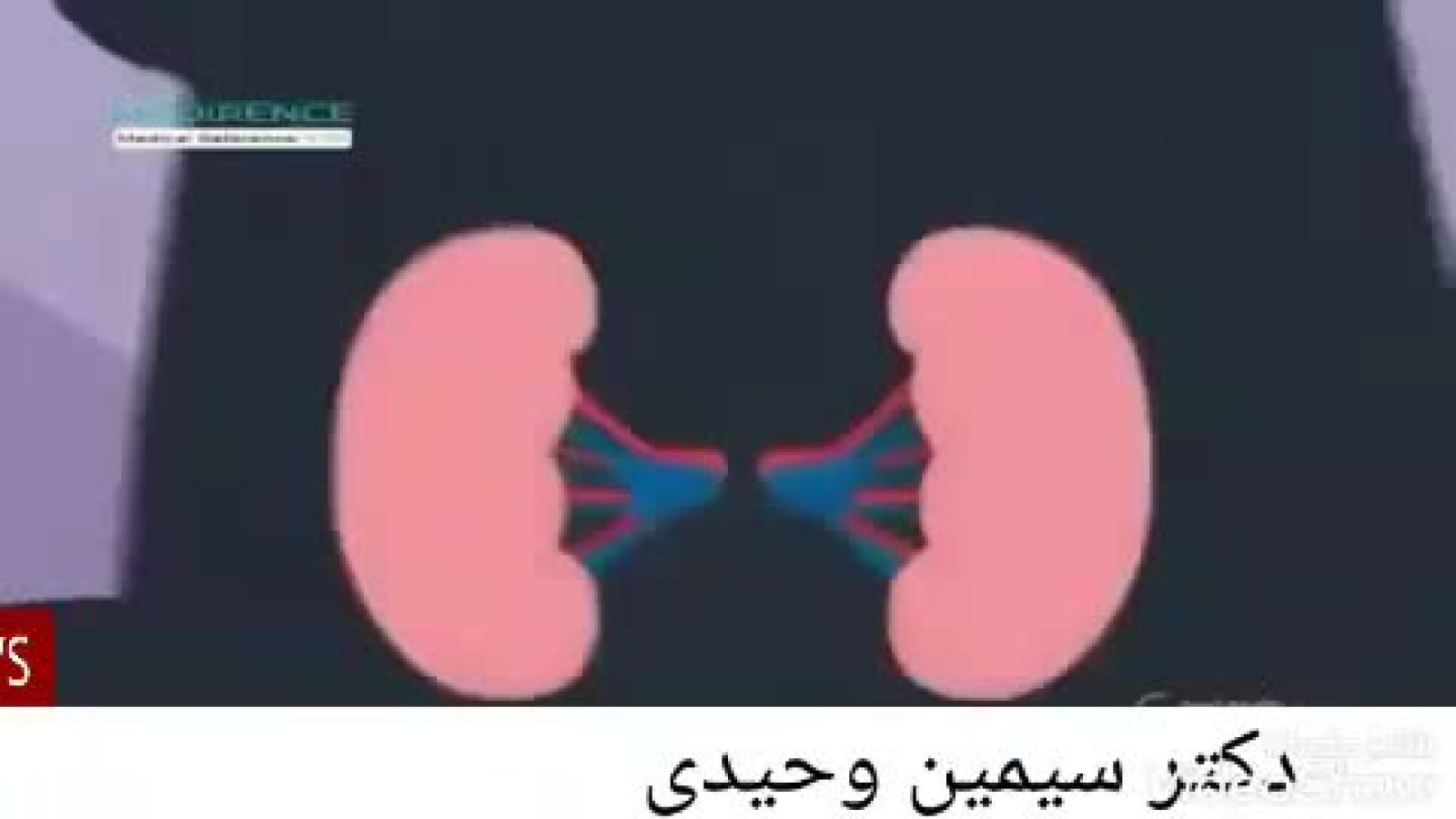 ⁣دیالیز کلیه